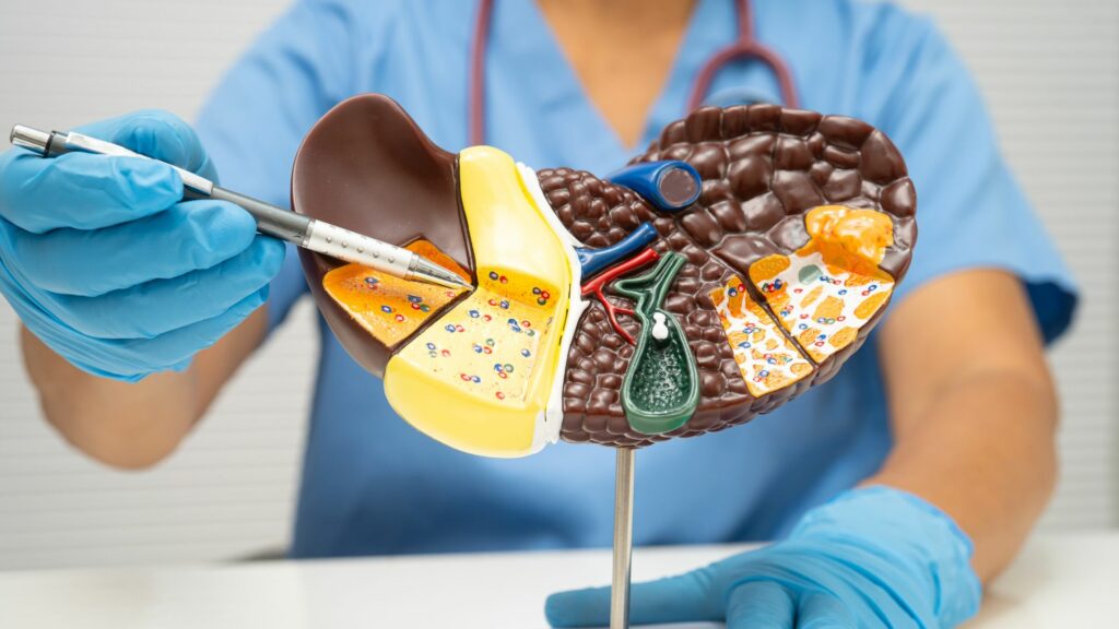 dieteticienne maladie du foie gras perpignan