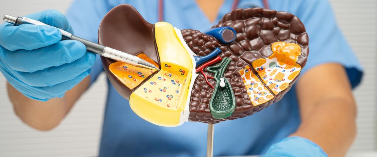 dieteticienne maladie du foie gras perpignan